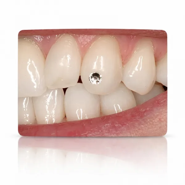 Bijuterii Dentare 